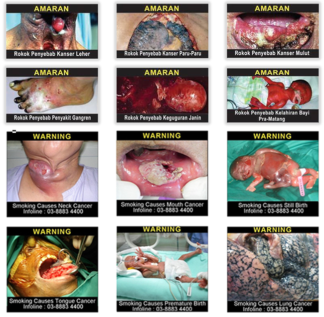 12 Pictorial Health Warning images